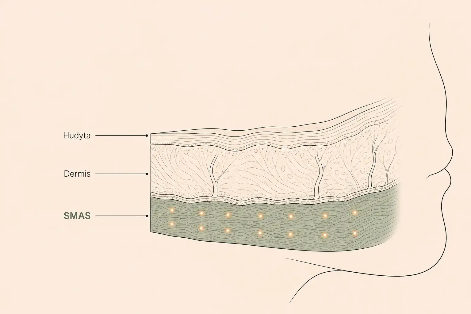 Tvärsnitt av huden: yta, dermis och SMAS-lagret där HIFU arbetar